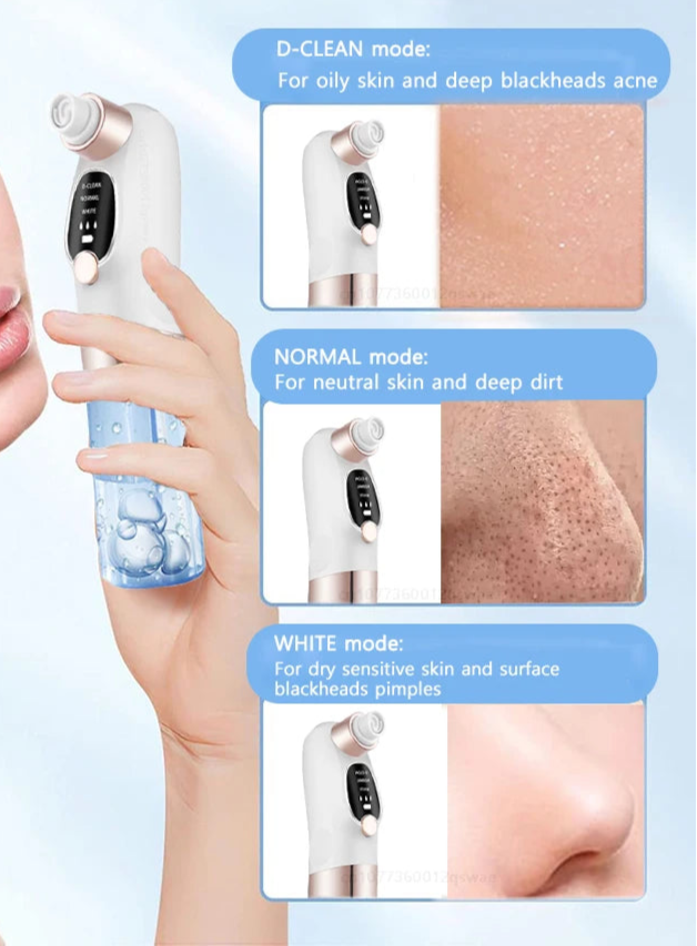 Porely - DeepClean™ Porensauger